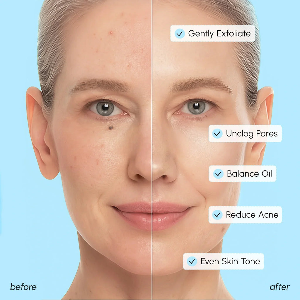 Maree Glycolic & Salicylic Acid Peel Pads — back view