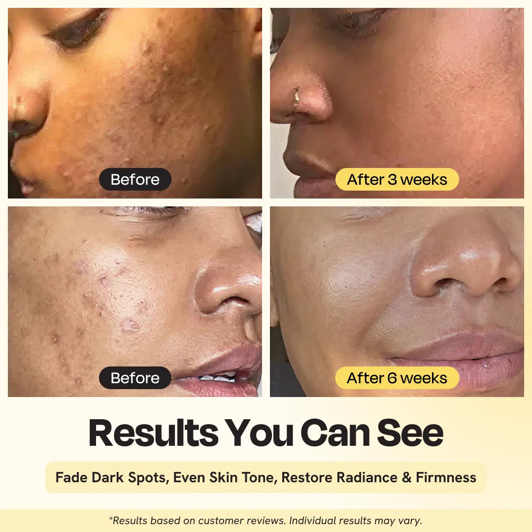 Gleamin Superactive Serum — 15% Vitamin C daily brightening serum