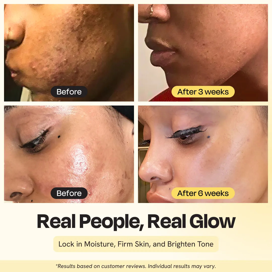 Gleamin Supernutrient Oil — lightweight brightening facial oil
