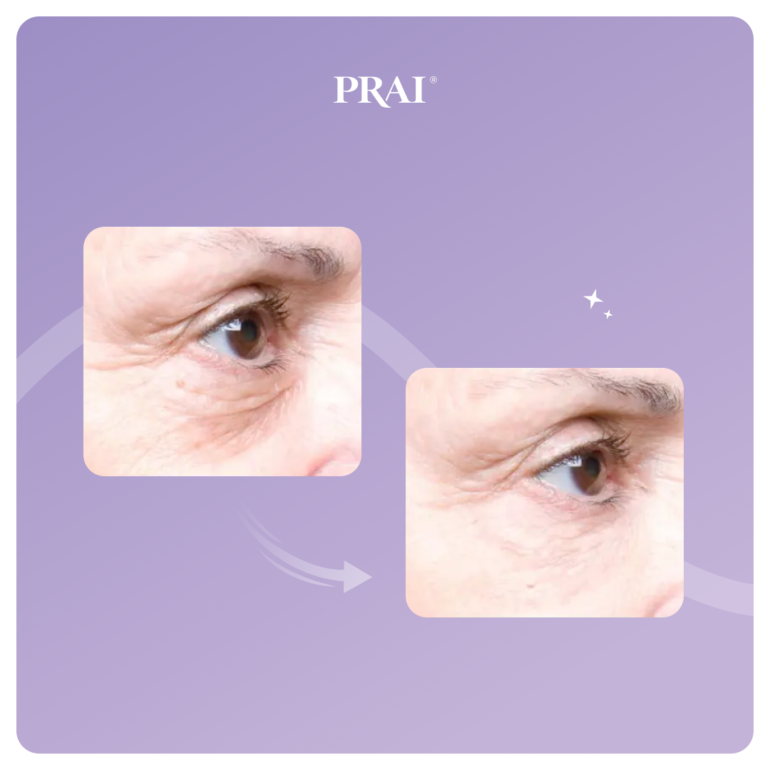 PRAI Beauty Ageless Eye Tight Uplift Serum — lifestyle context