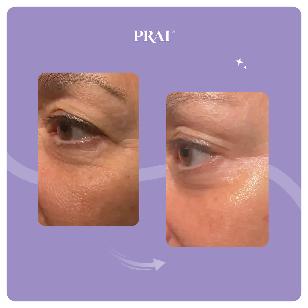 PRAI Beauty Ageless Eye Tight Uplift Serum — side view