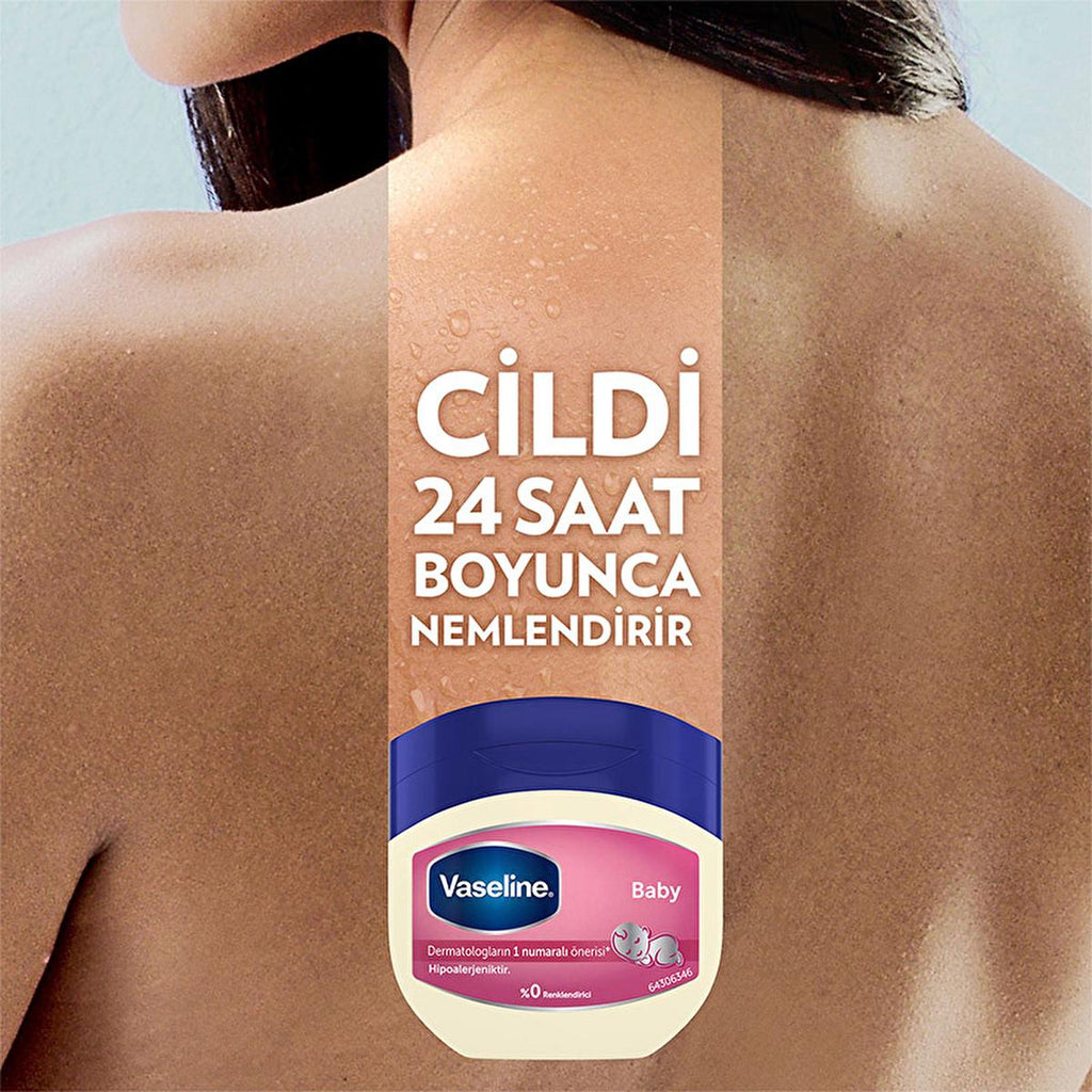 Vaseline Baby Moisturizing Jelly - Hypoallergenic, 24-Hour Hydration for Dry Skin - Dermatologist-Recommended
