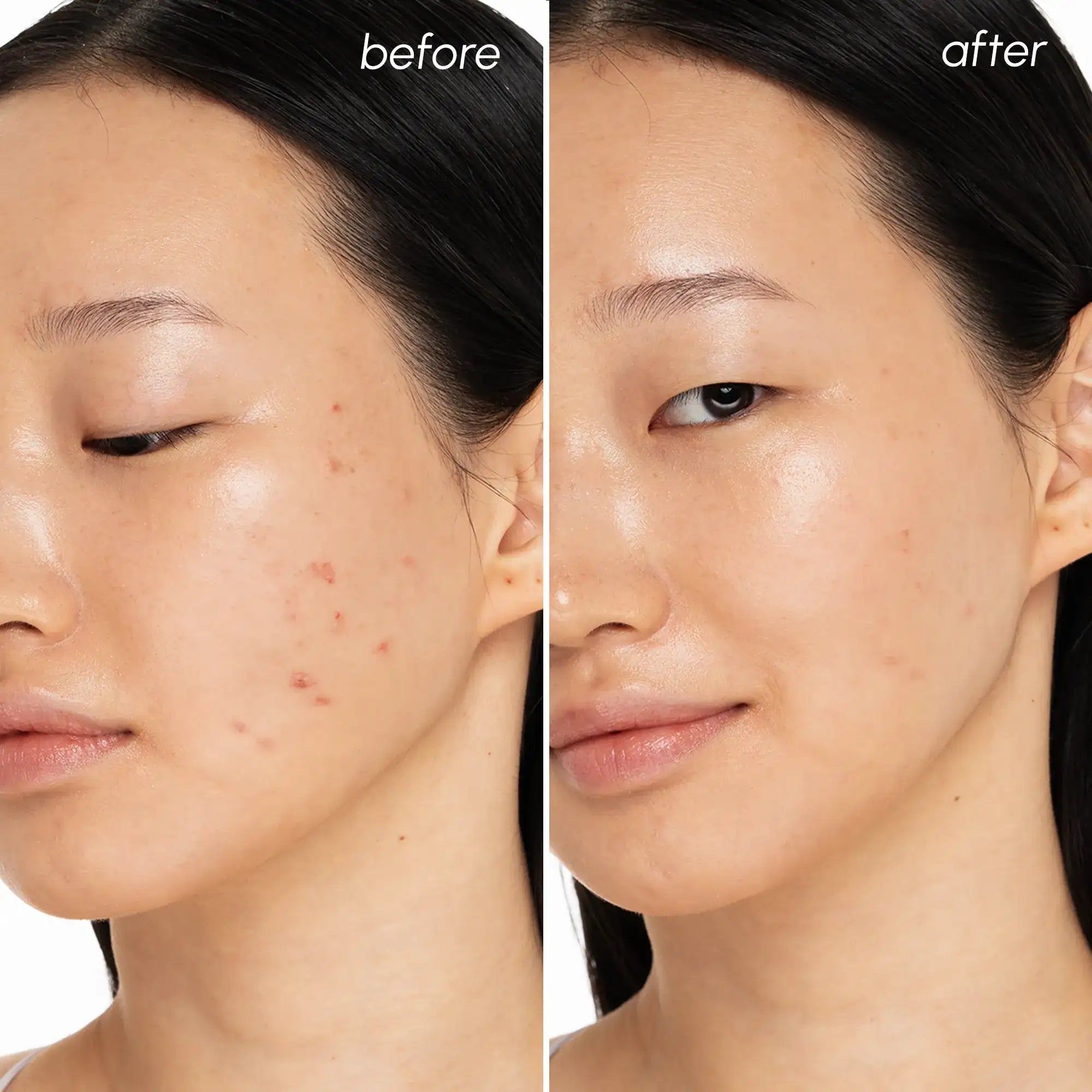 Maree Witch Hazel Clearing Pads — lifestyle context