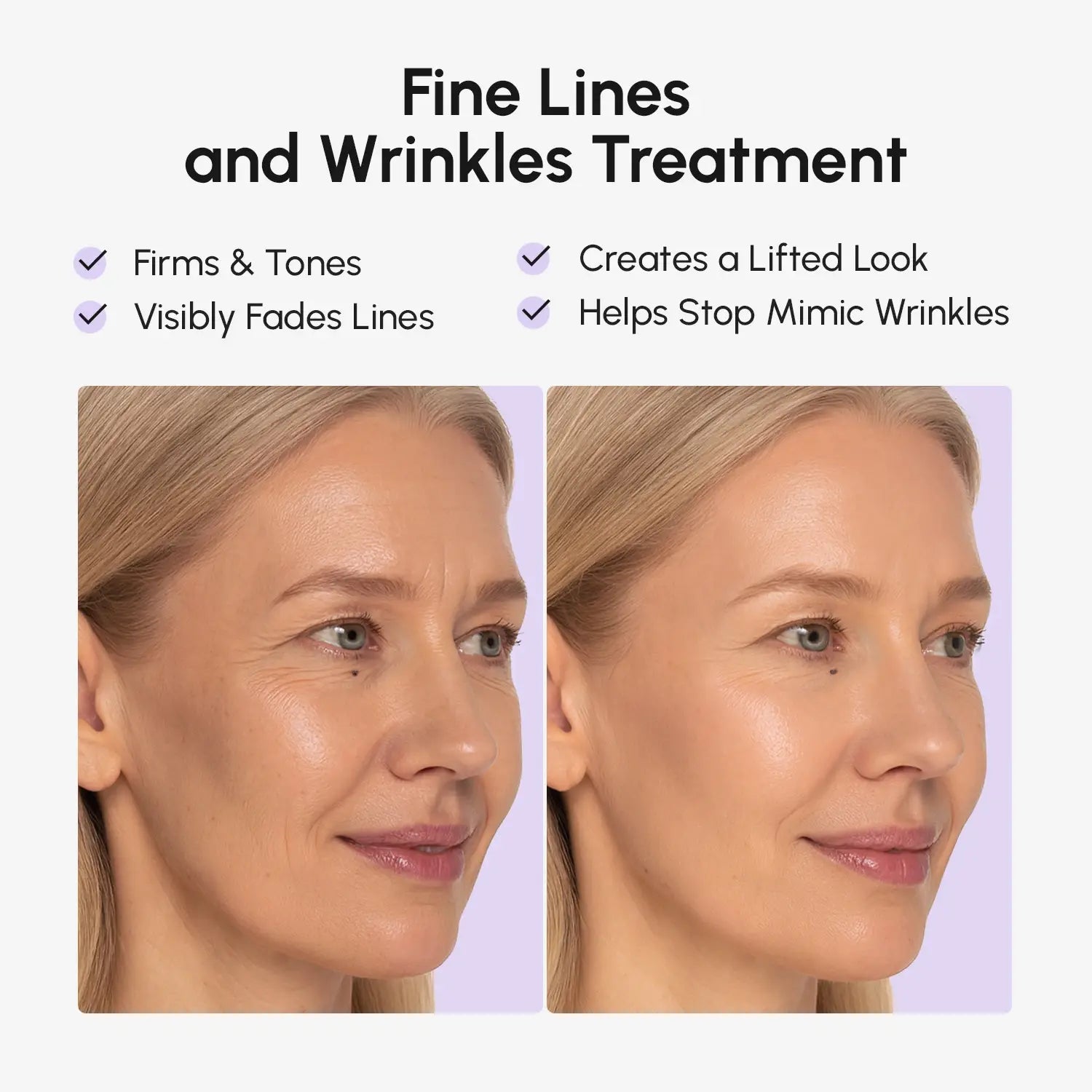 Maree Anti-wrinkle Tape Patches — lifestyle context