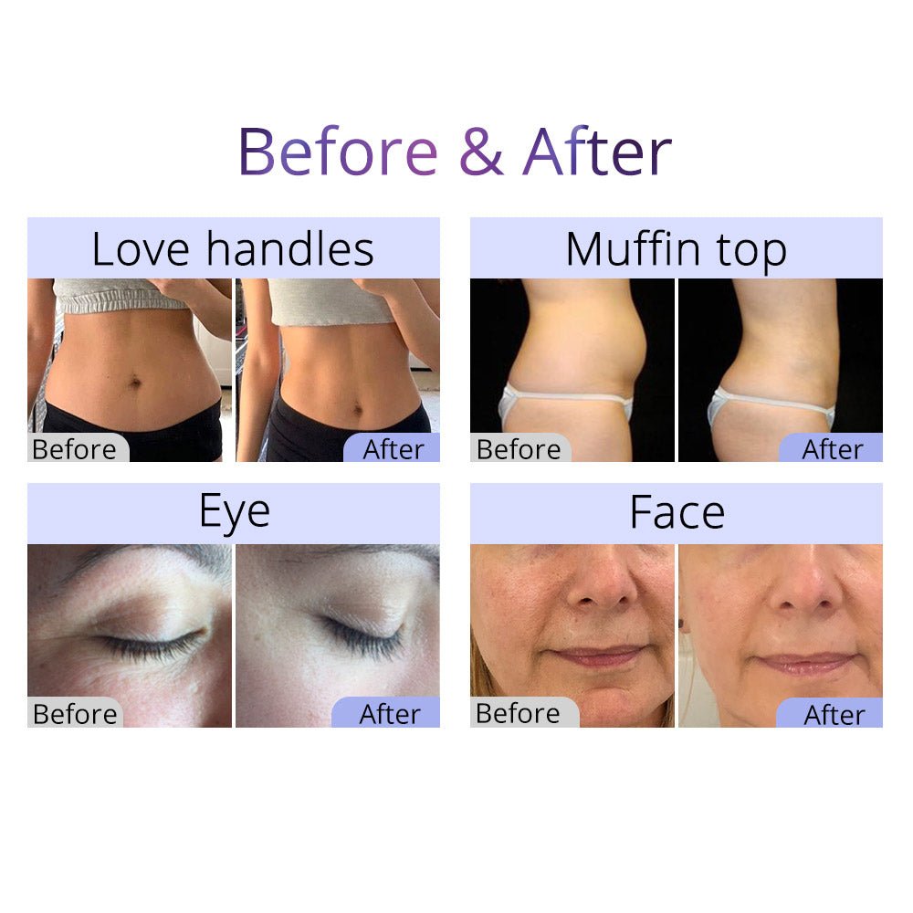 Aristorm 40K Cavitation 2.5 RF Skin Scrubber & Facial System – Cavitation Machines, view 20