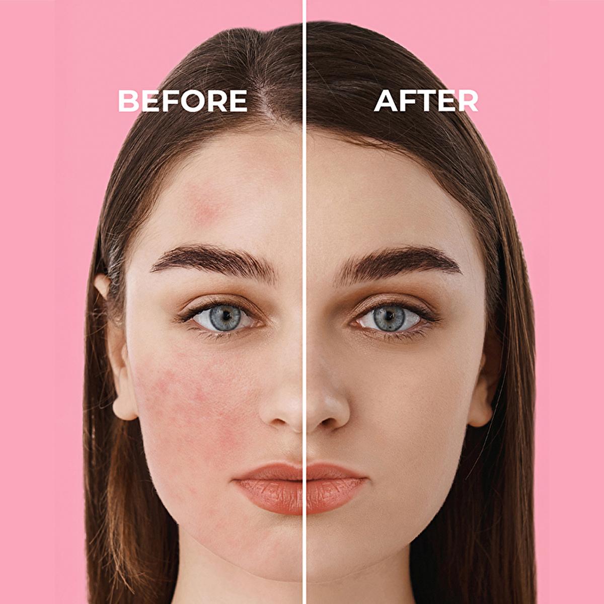 Sinoz Pink Touch SPF50+ Tone-Up Sunscreen: Color Correcting, Redness Reducing, and Brightening Mineral Facial Sunscreen with Hyaluronic Acid - 1.69 fl oz