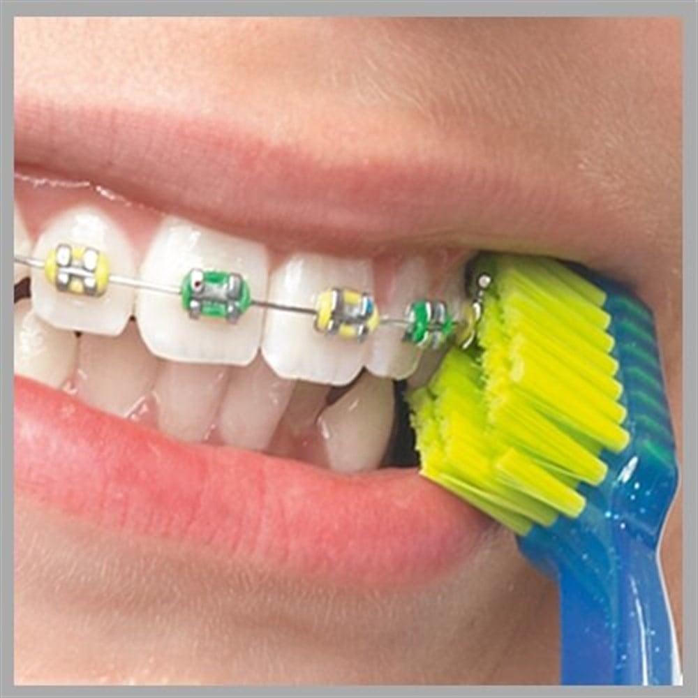 Curaprox CS 5460 Orthodontic Toothbrush - Gentle, Effective Oral Care for Braces & Orthodontic Appliances