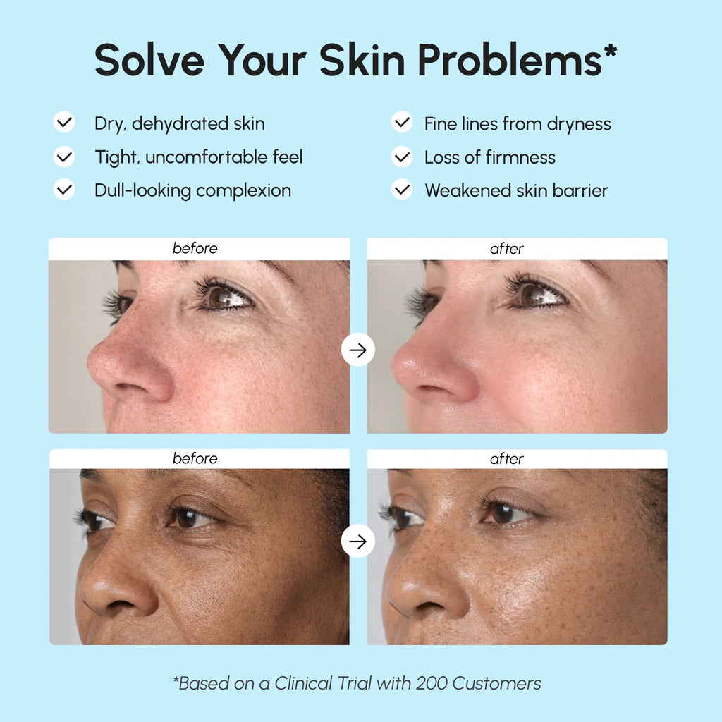 Maree Deep Moisture Collagen Face Cream — lifestyle context
