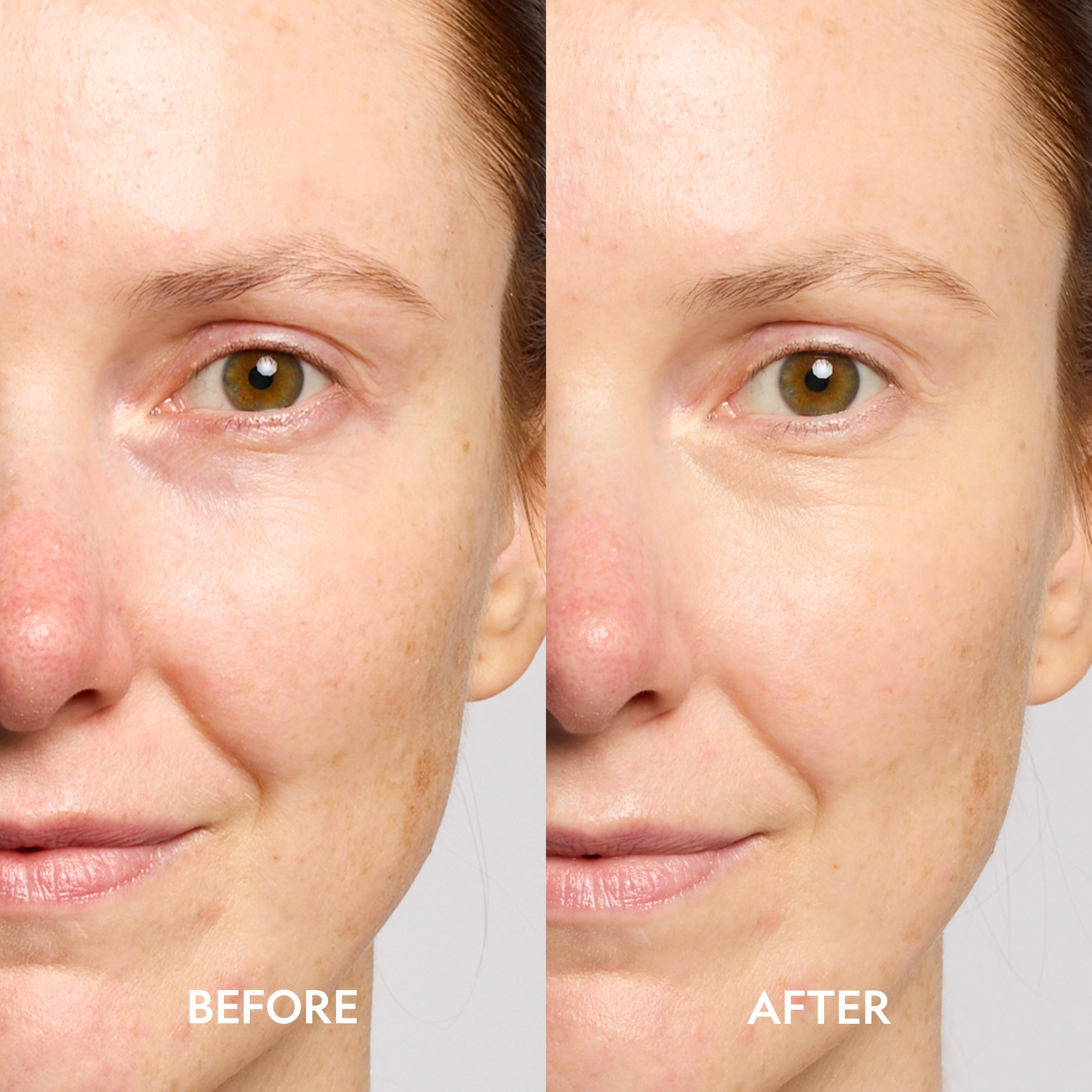 Super Bright Dark Circle Serum Peptide Corrector by YENSA — detail shot 4