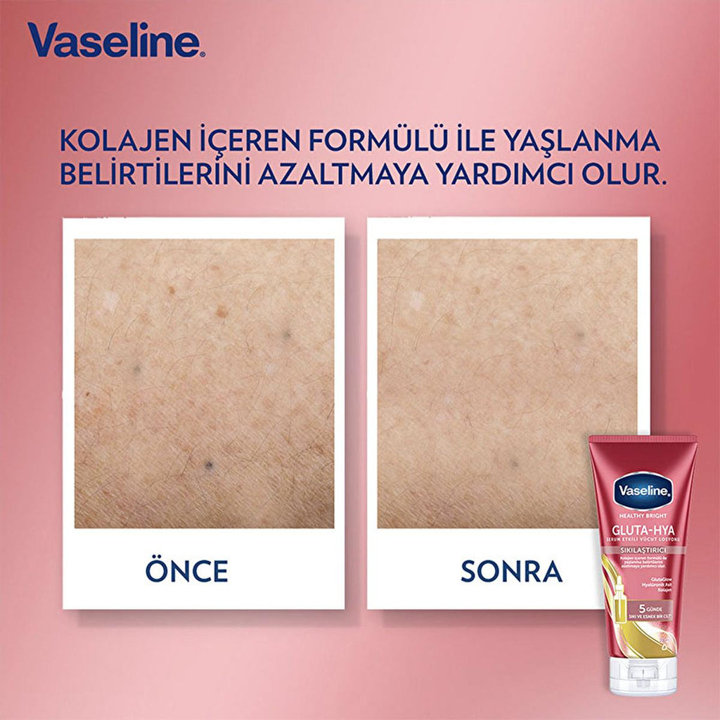 Vaseline Gluta-Hya Firming Body Lotion: Hyaluronic Acid & Collagen for Radiant, Firmer Skin - Intense Hydration, Anti-Aging, Non-Greasy Formula