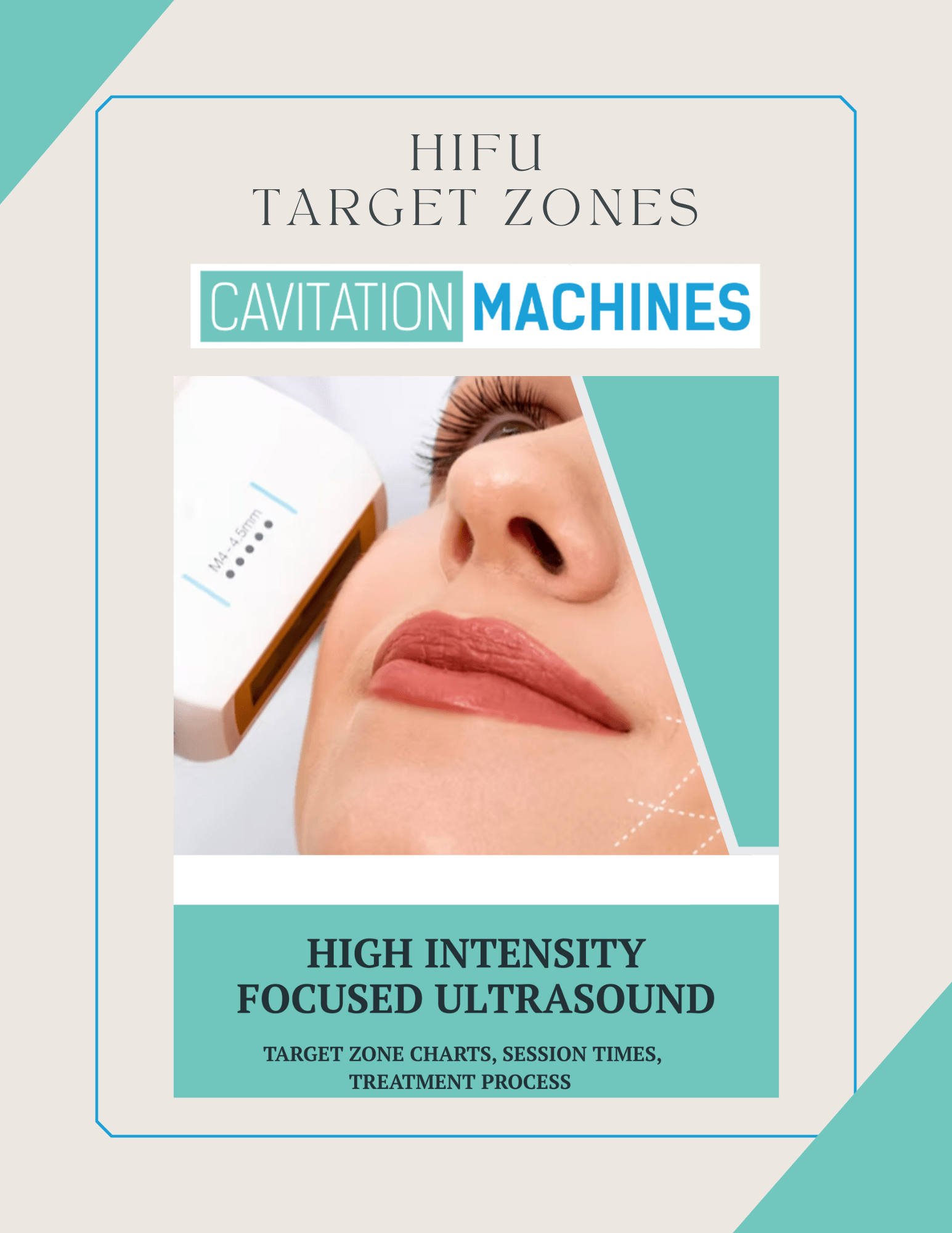 Shape Tactics HIFU Target Zone Chart – Cavitation Machines