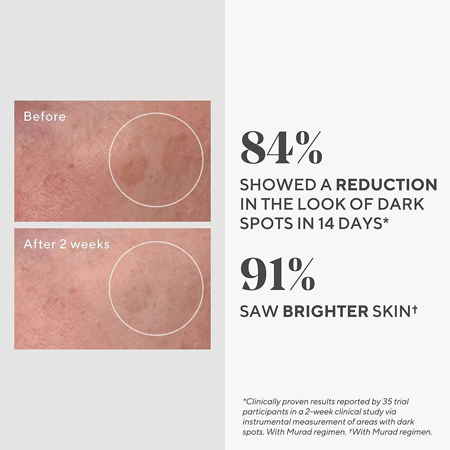 DR.Murad Dark Spot Correcting Serum - Rapidly Reduces Hyperpigmentation, Evens Skin Tone, 30ml
