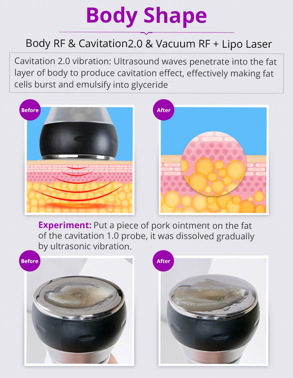 Kim 10 6-in-1 Cavitation RF Lipo Laser System – Cavitation Machines, view 8