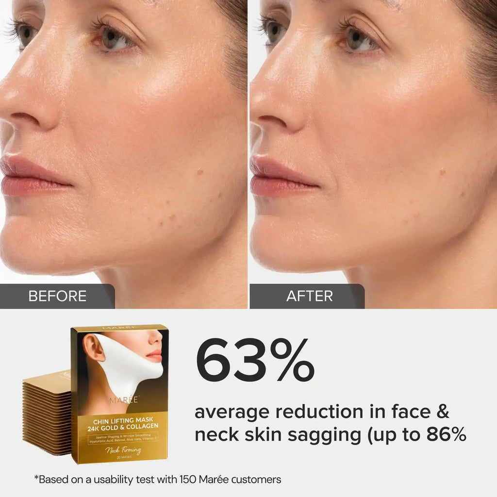Maree 24K Gold V-Line Lifting Mask — in-use photo