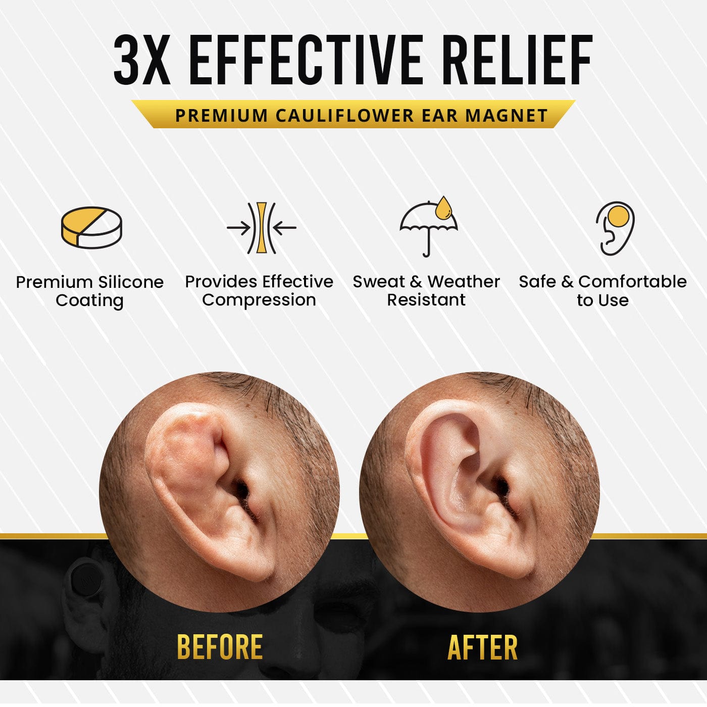 MagnetRX Cauliflower Ear Treatment Magnet Kit — construction detail