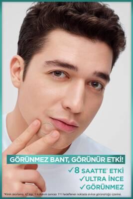 Garnier Pure Active: Anti-Acne Pore Strips with Salicylic Acid & Tea Tree Oil - Blackhead Remover, Facial Cleanser (22 Strips)