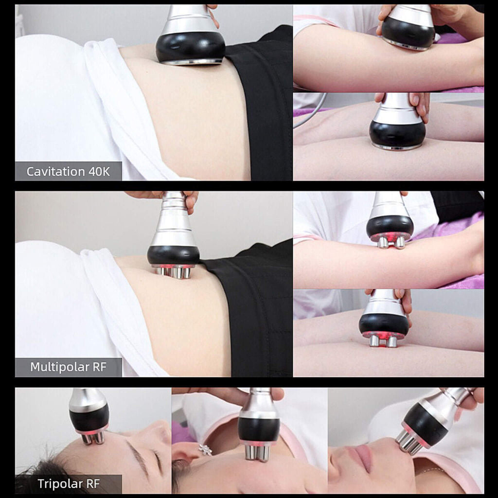 Professional Ultrasonic Cavitation RF Laser Lipo Machine - Fat Reduction & Weight Loss (SAK95112) – SAKSBY WHOLESALE, view 10