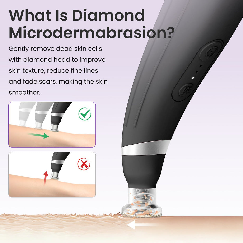 Shape Tactics 12-Tip Diamond Microdermabrasion Kit – Cavitation Machines, view 4