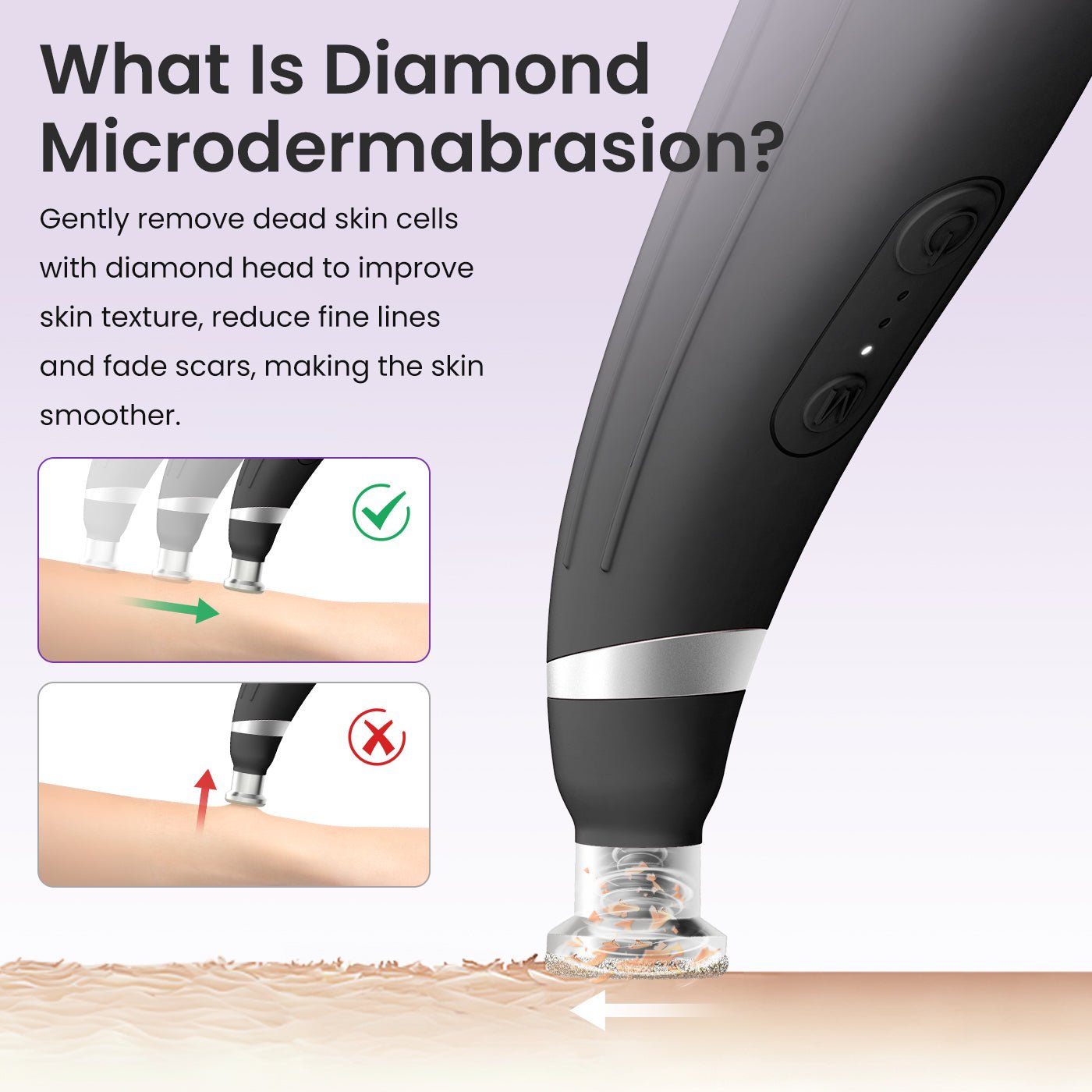 Shape Tactics 12-Tip Diamond Microdermabrasion Kit – Cavitation Machines, view 4