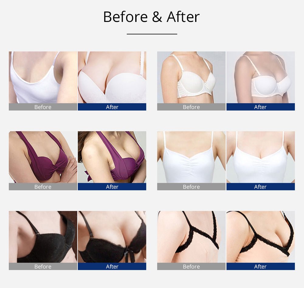 Shape Tactics 120ml Vacuum Massage & Breast Enhancement System – Cavitation Machines, view 16