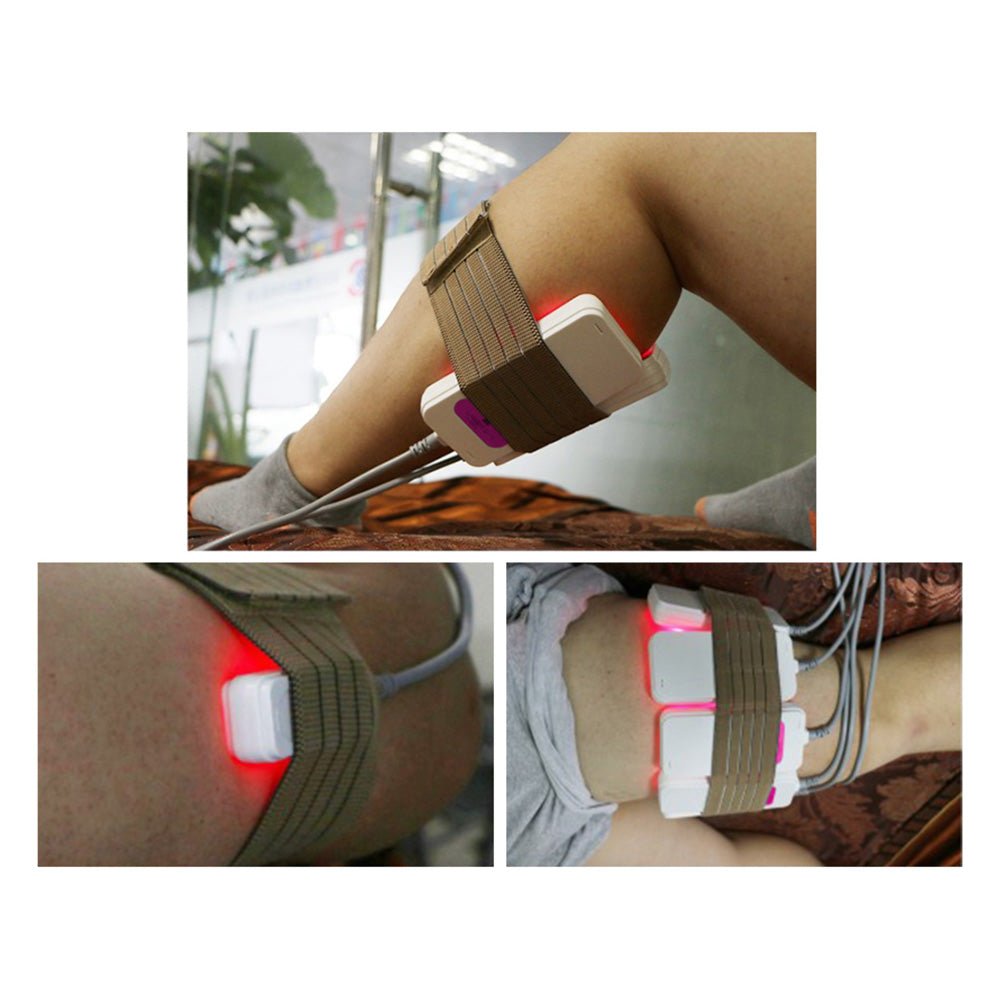 Shape Tactics 160mW 10-Pad Slimming Body System – Cavitation Machines, view 12