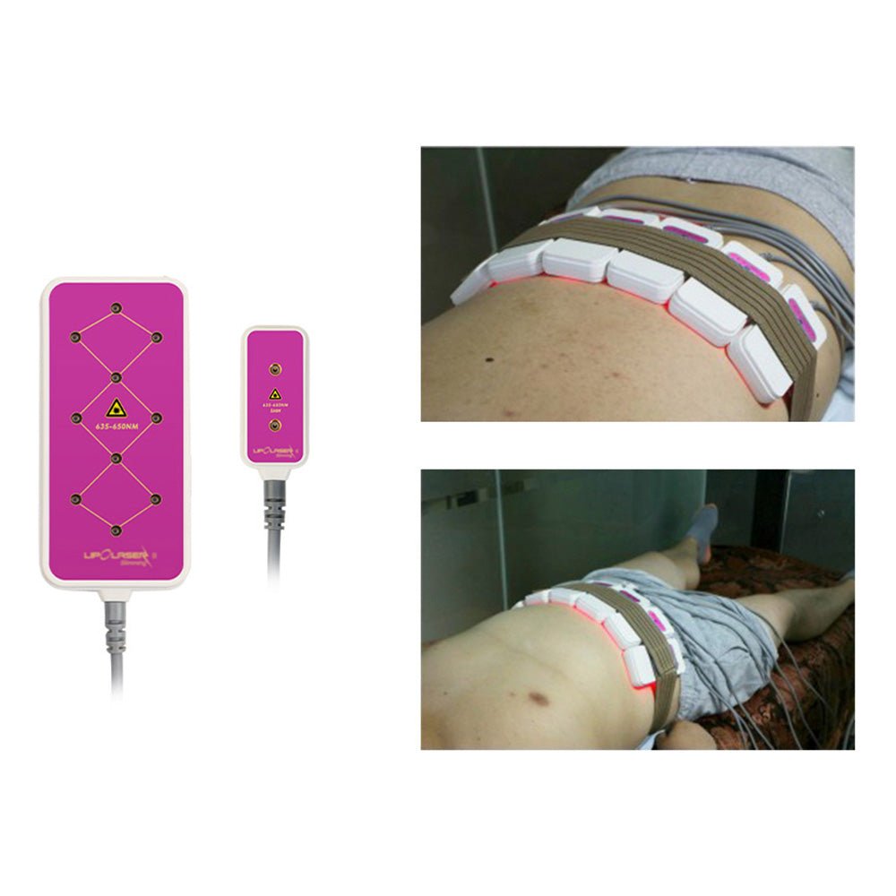 Shape Tactics 160mW 10-Pad Slimming Body System – Cavitation Machines, view 11