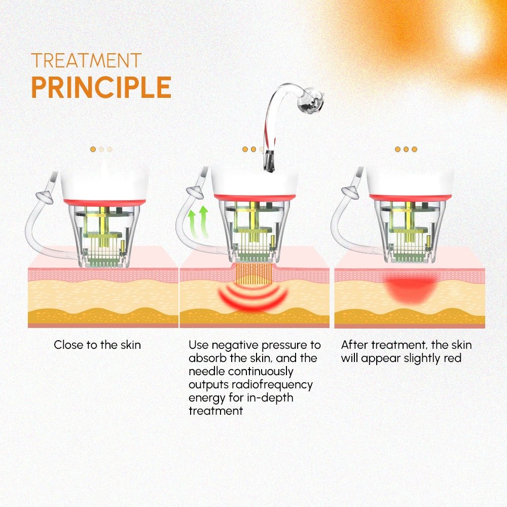Shape Tactics 3-in-1 Targeted RF Microneedling System – Cavitation Machines, view 6