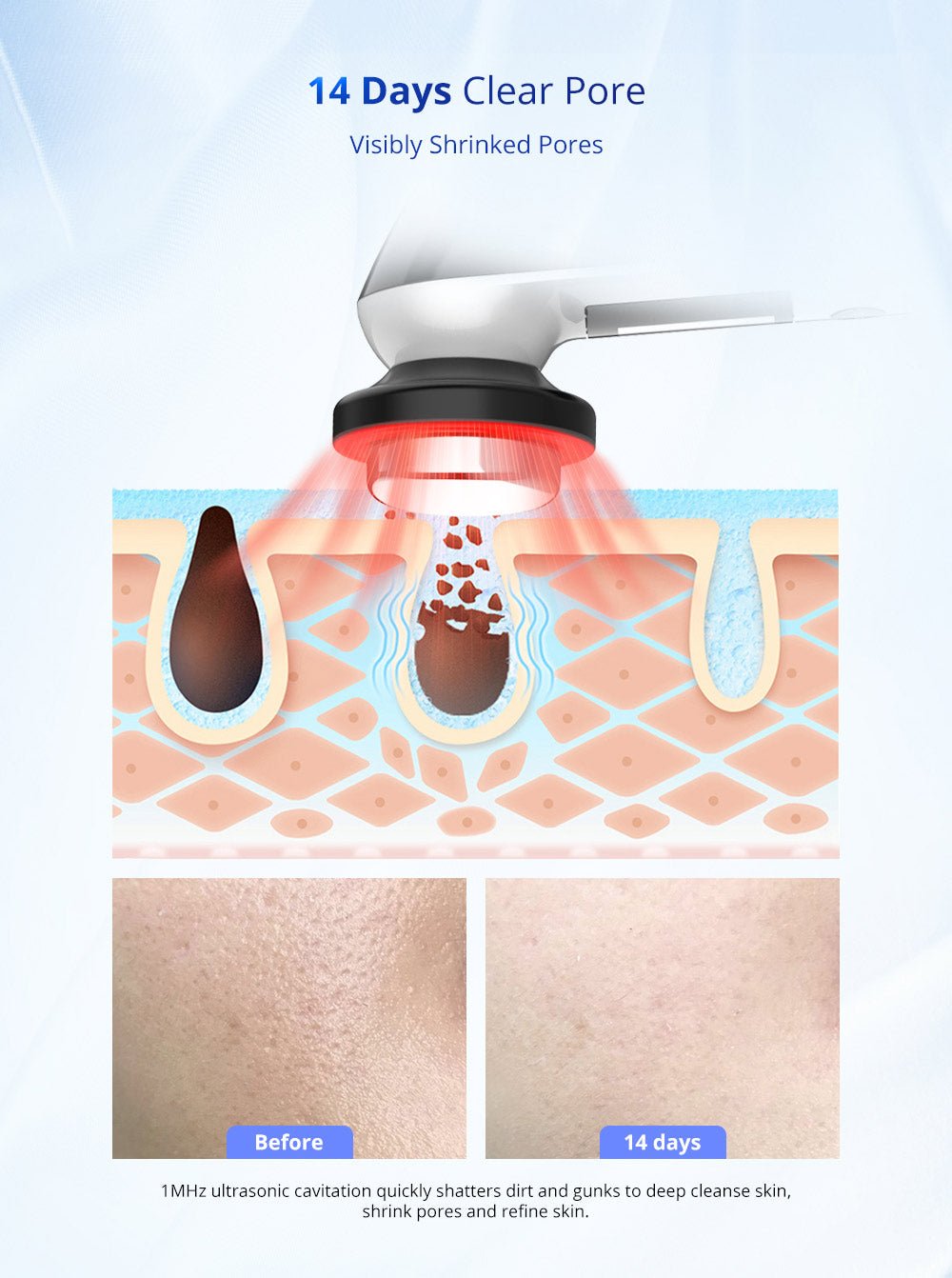 Shape Tactics 3-in-1 Ultrasonic Facial EMS LED Photon Therapy – Cavitation Machines, view 12