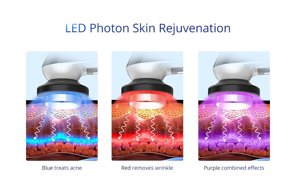 Shape Tactics 3-in-1 Ultrasonic Facial EMS LED Photon Therapy – Cavitation Machines, view 14