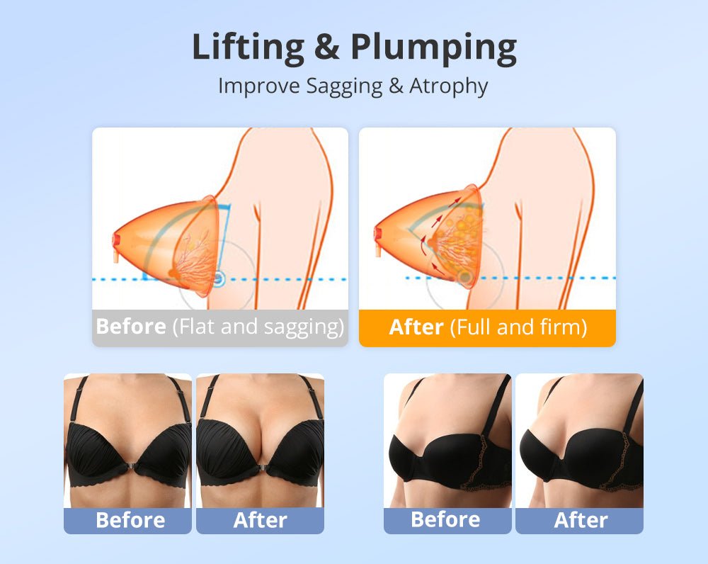 Shape Tactics 40K Cavitation and RF Vacuum Contouring System – Cavitation Machines, view 17