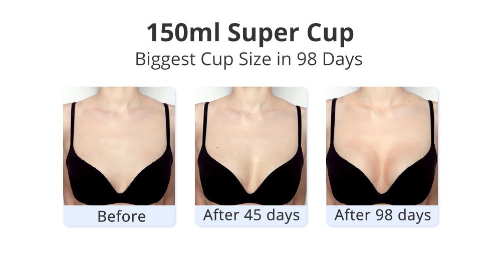 Shape Tactics 40K Cavitation and RF Vacuum Contouring System – Cavitation Machines, view 16