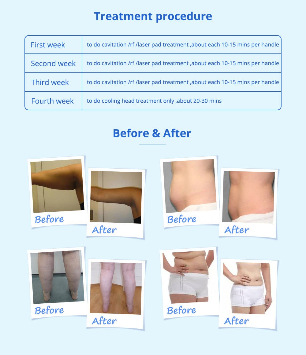 Shape Tactics 5-in-1 Cavitation Cryolipolysis Lipo Laser System – Cavitation Machines, view 11