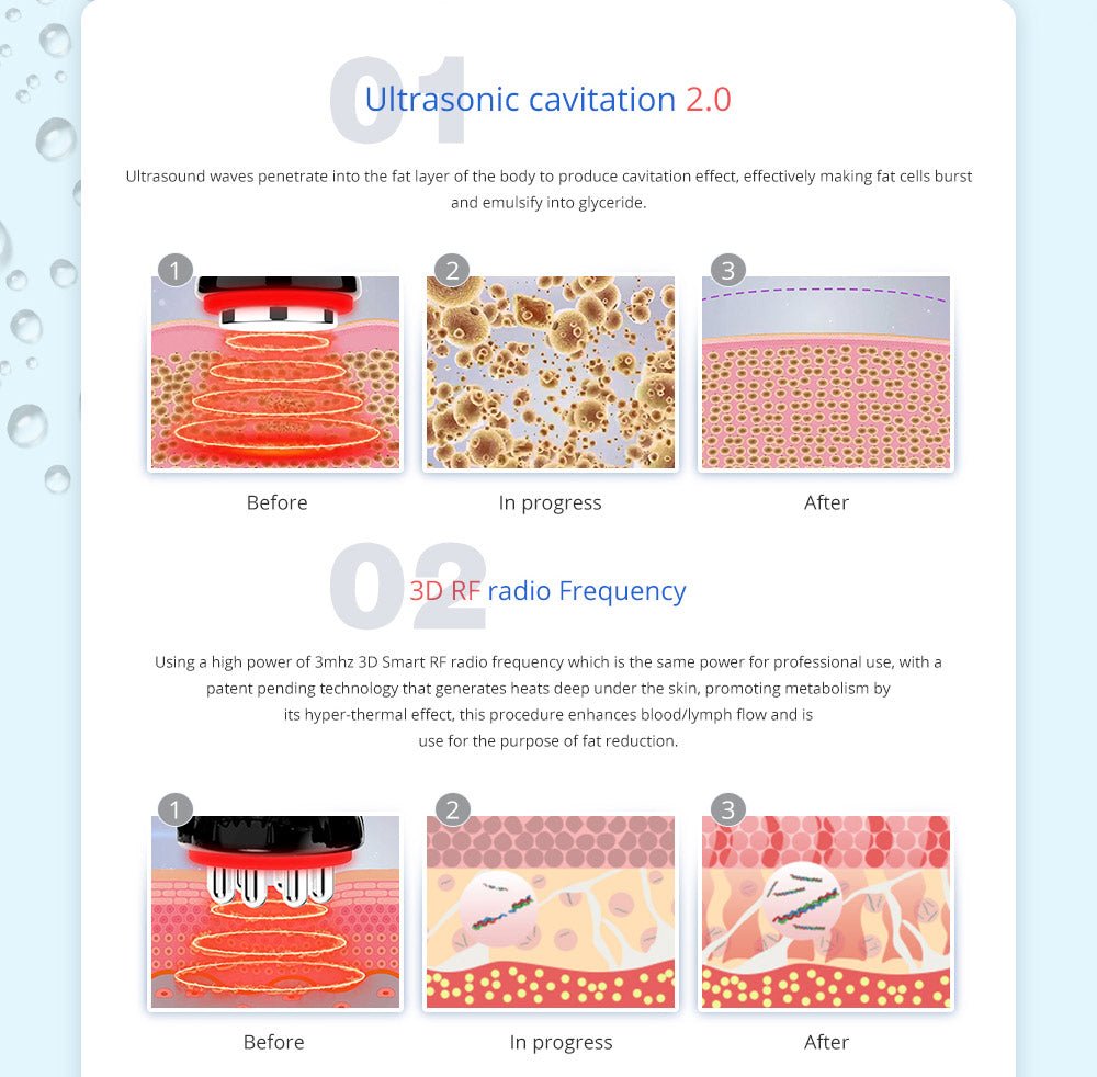 Shape Tactics 5-in-1 Cavitation Cryolipolysis Lipo Laser System – Cavitation Machines, view 10