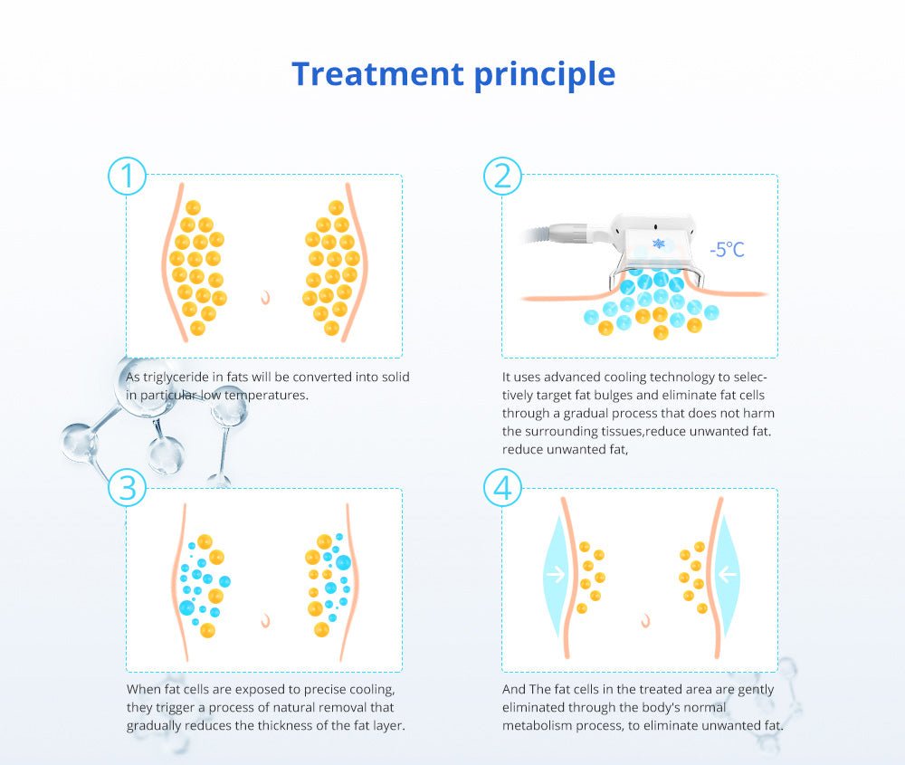 Shape Tactics 5-in-1 Cavitation Cryolipolysis Lipo Laser System – Cavitation Machines, view 8