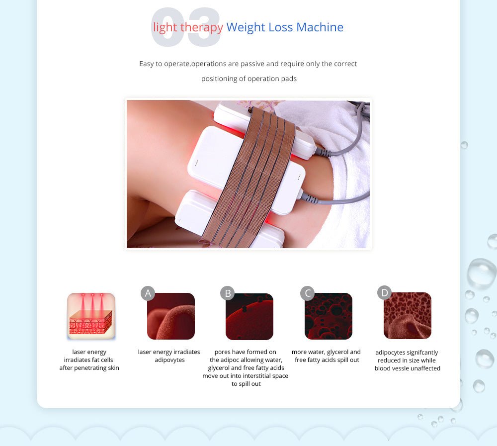 Shape Tactics 5-in-1 Cavitation Cryolipolysis Lipo Laser System – Cavitation Machines, view 7
