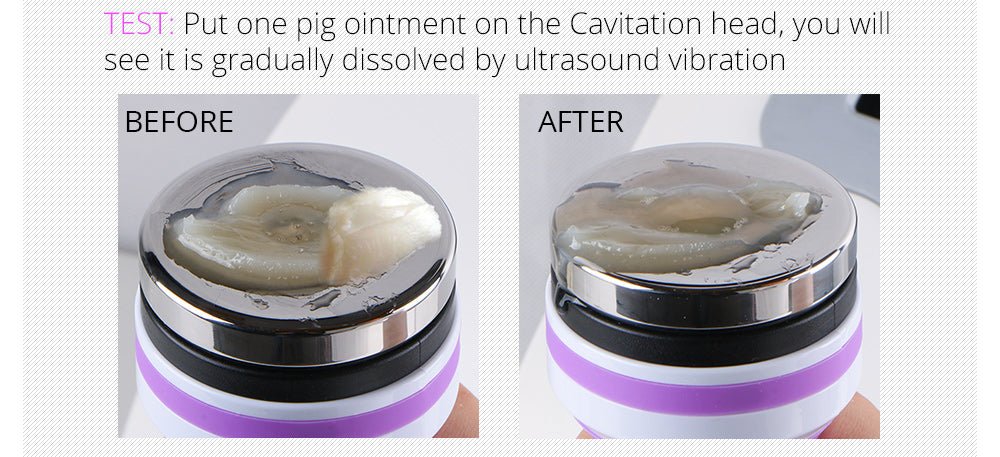 Shape Tactics 5-in-1 RF Cavitation Body Contouring System – Cavitation Machines, view 10