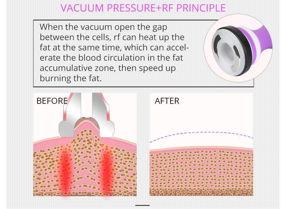 Shape Tactics 5-in-1 RF Cavitation Body Contouring System – Cavitation Machines, view 13