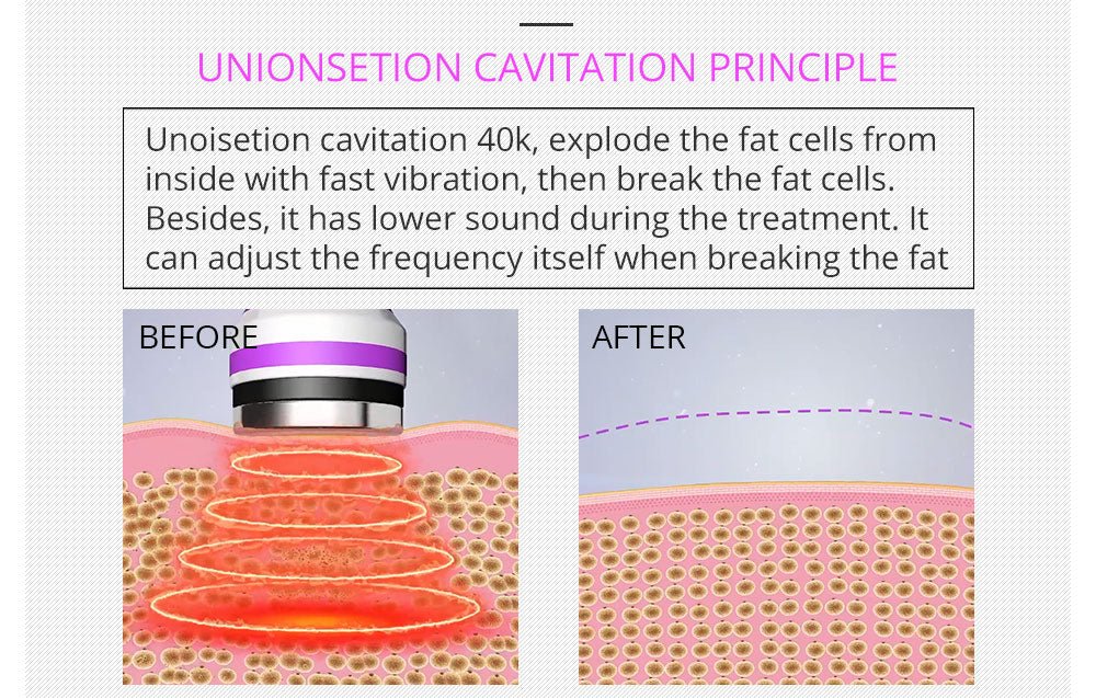 Shape Tactics 5-in-1 RF Cavitation Body Contouring System – Cavitation Machines, view 11