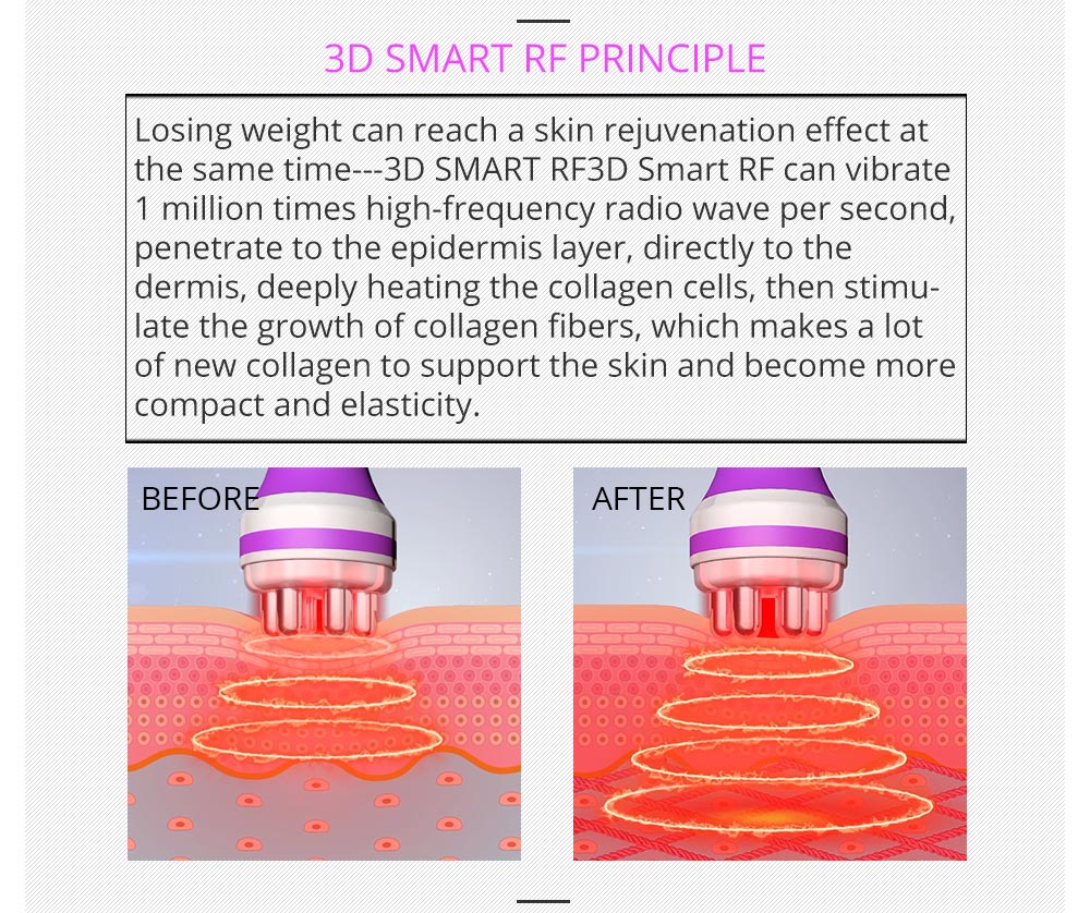 Shape Tactics 5-in-1 RF Cavitation Body Contouring System – Cavitation Machines, view 12