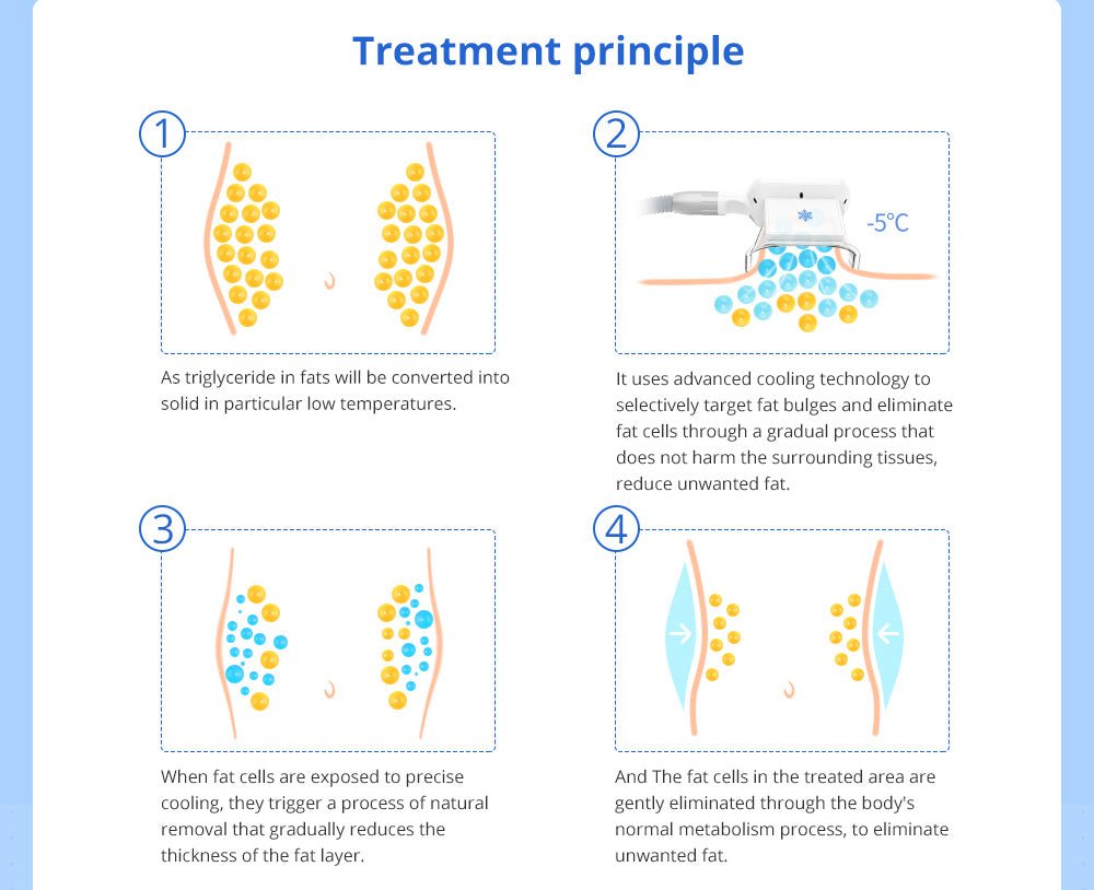 Shape Tactics 5-in-1 Cavitation RF Vacuum LED Laser Body Contouring System – Cavitation Machines, view 11