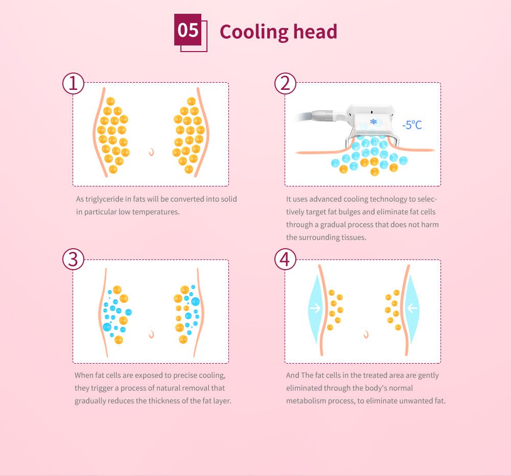Shape Tactics 5-in-1 Cryolipolysis Vacuum RF Cooling System – Cavitation Machines, view 14