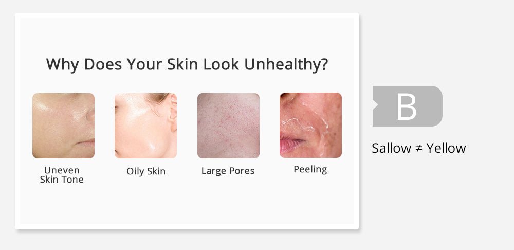 Shape Tactics 5-in-1 Diamond Microdermabrasion and Ultrasonic Skincare System – Cavitation Machines, view 6