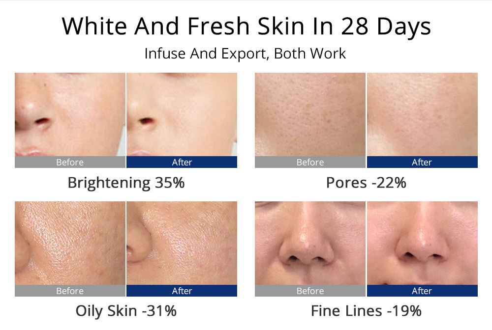Shape Tactics 5-in-1 Diamond Microdermabrasion and Ultrasonic Skincare System – Cavitation Machines, view 10