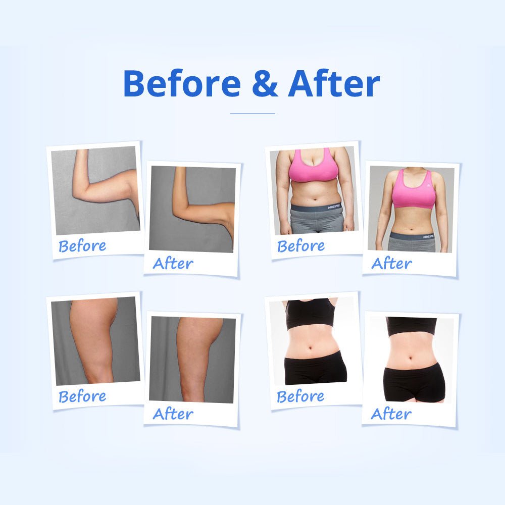 Shape Tactics 5-in-1 RF & 40K Cavitation Contouring System – Cavitation Machines, view 11
