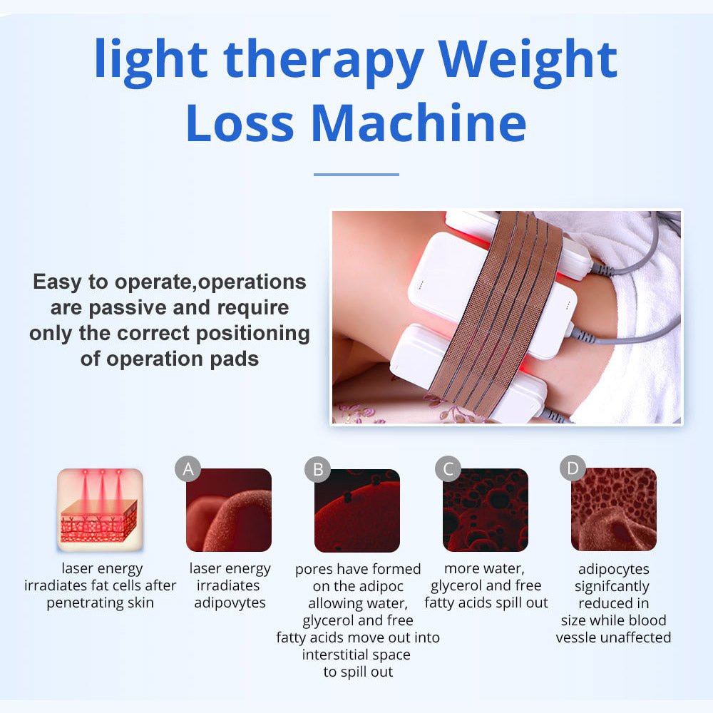 Shape Tactics 5-in-1 RF & 40K Cavitation Contouring System – Cavitation Machines, view 8