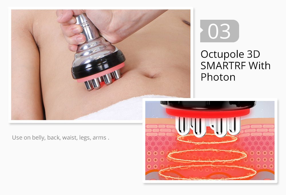 Shape Tactics 5-in-1 Unoisetion Cavitation 2.0 3D Smart Vacuum RF System – Cavitation Machines, view 15