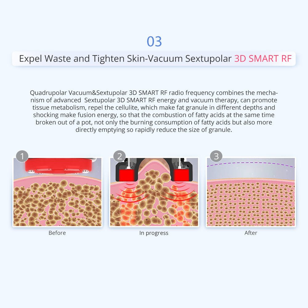Shape Tactics 5-in-1 Unoisetion Vacuum RF System – Cavitation Machines, view 11