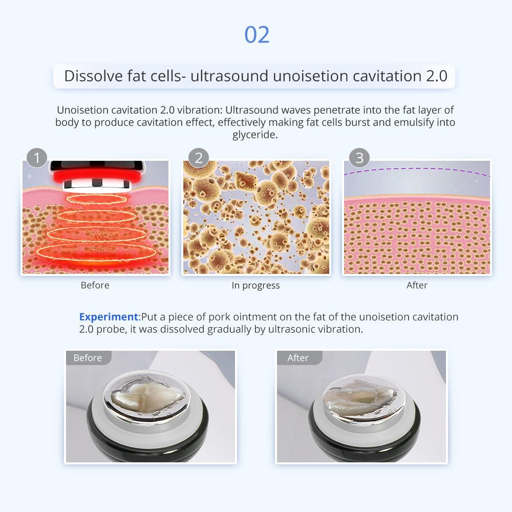 Shape Tactics 5-in-1 Unoisetion Vacuum RF System – Cavitation Machines, view 10