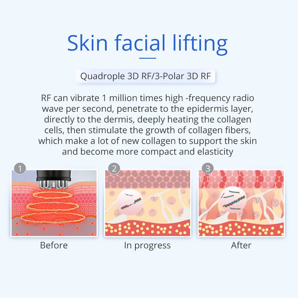 Shape Tactics 5-in-1 Unoisetion Ultrasonic RF Cavitation System – Cavitation Machines, view 13