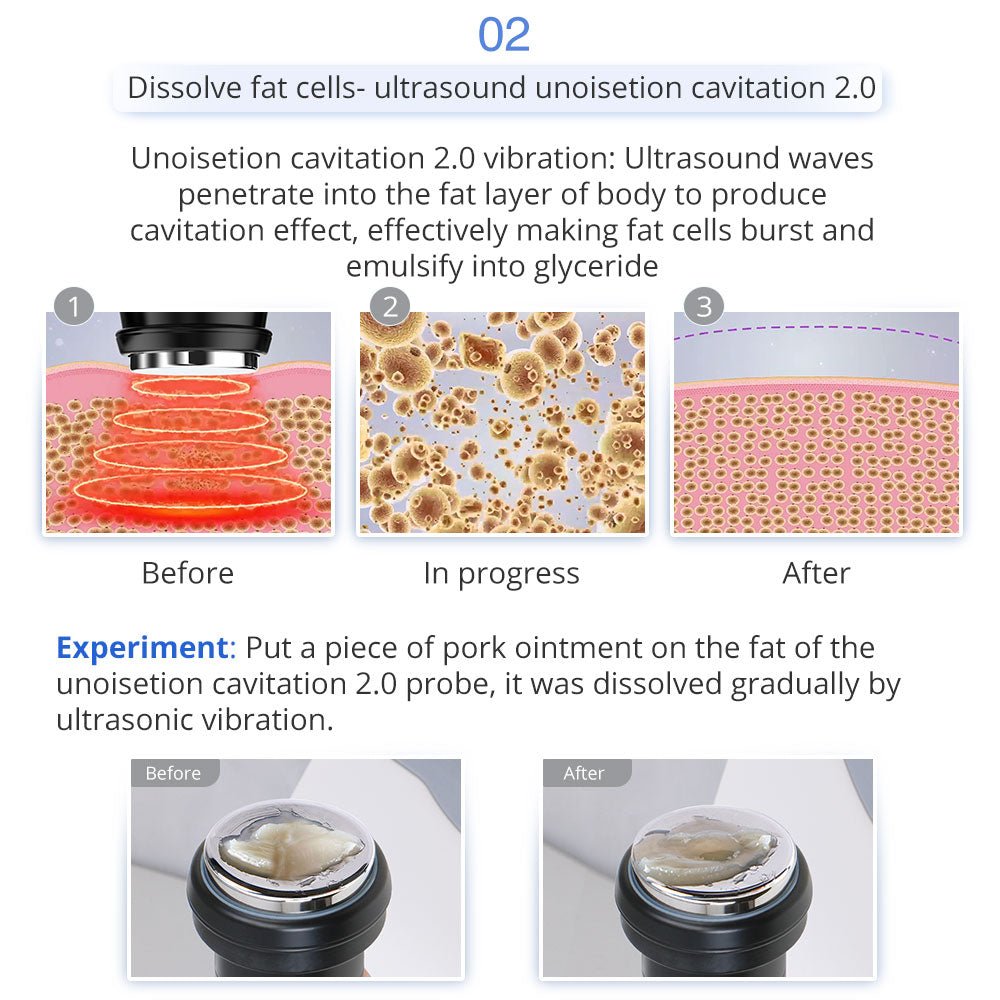 Shape Tactics 5-in-1 Unoisetion Ultrasonic RF Cavitation System – Cavitation Machines, view 9